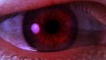 Ander's red eye.jpg