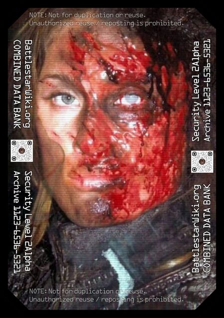 Allison Warnyca in prosthetics for her injury scene in "Razor Flashbacks."